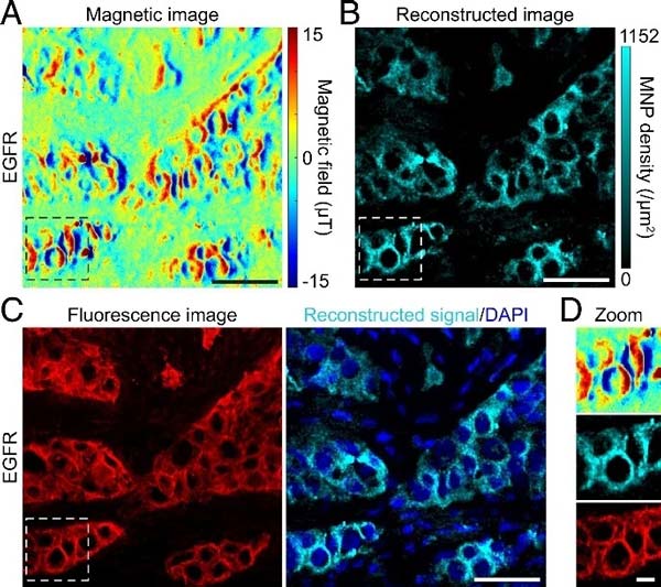 アプリケーション-nvcenter-cell-research-肺-癌-組織