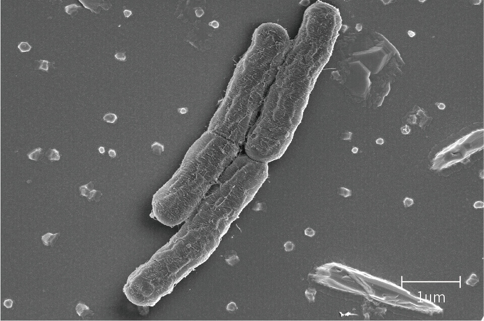 SEM 分析画像 - 大腸菌
