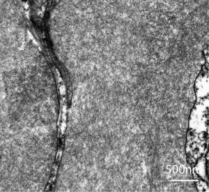 sem image analysis Renal Pathology Section